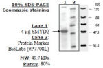 SMYD2 Active human, recombinant, expressed in baculovirus infected insect cells, >=80% (SDS-PAGE)