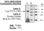 SUV4-20H1 human, recombinant, expressed in E. coli, >=20% (SDS-PAGE)