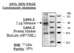 Metnase (SETMAR) human, recombinant, expressed in FreeStyle 293-F cells, >=30% (SDS-PAGE)