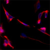 MONOCLONAL ANTI-BETA-TUBULIN III NEURON