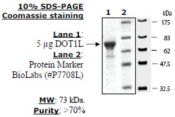 Dot1L human, recombinant, expressed in E. coli, >=70% (SDS-PAGE)