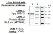 PRMT1 human, recombinant, expressed in E. coli, >=50% (SDS-PAGE)
