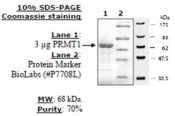 PRMT1 Active human, recombinant, expressed in baculovirus infected insect cells, >=70% (SDS-PAGE)