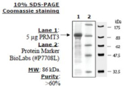 PRMT3 human, recombinant, expressed in E. coli, >=60% (SDS-PAGE)