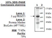 PRMT5 (Sf9) Active human, recombinant, expressed in baculovirus infected insect cells, >=70% (SDS-PA