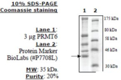 PRMT6 human, recombinant, expressed in FreeStyle 293-F cells, >=70% (SDS-PAGE)