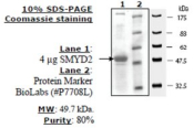 SMYD2 Active human, recombinant, expressed in baculovirus infected insect cells, >=80% (SDS-PAGE)