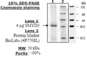 SMYD3 (full length) Active human, recombinant, expressed in baculovirus infected insect cells, >=50%