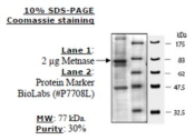Metnase (SETMAR) human, recombinant, expressed in FreeStyle 293-F cells, >=30% (SDS-PAGE)