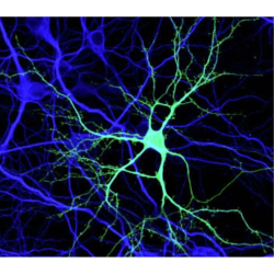 Transfection