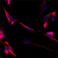 MONOCLONAL ANTI-BETA-TUBULIN III NEURON