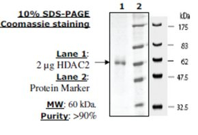 HDAC 2 His tag human, recombinant, expressed in baculovirus infected insect cells, >=80% (SDS-PAGE)
