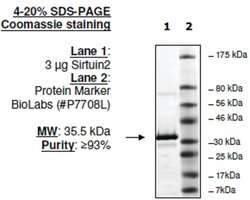 Sirtuin 2 human, recombinant, expressed in E. coli, >=80% (SDS-PAGE)