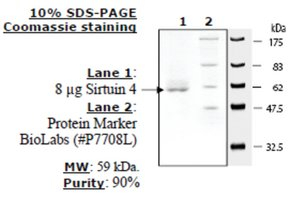 Sirtuin 4 human, recombinant, expressed in E. coli, >=70% (SDS-PAGE)