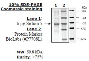 Sirtuin 5 human, recombinant, expressed in E. coli, >=50% (SDS-PAGE)