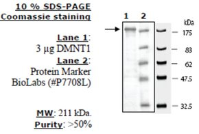 DNMT1 Active human, recombinant, expressed in baculovirus infected insect cells, >=50% (SDS-PAGE)