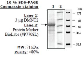 DNMT2 Active human, recombinant, expressed in baculovirus infected insect cells, >=80% (SDS-PAGE)