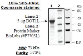 Dot1L human, recombinant, expressed in E. coli, >=70% (SDS-PAGE)