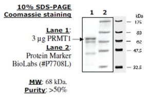 PRMT1 human, recombinant, expressed in E. coli, >=50% (SDS-PAGE)