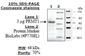 PRMT1 Active human, recombinant, expressed in baculovirus infected insect cells, >=70% (SDS-PAGE)