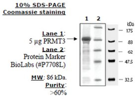 PRMT3 human, recombinant, expressed in E. coli, >=60% (SDS-PAGE)