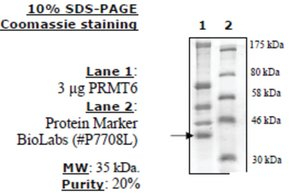 PRMT6 human, recombinant, expressed in FreeStyle 293-F cells, >=70% (SDS-PAGE)