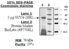 SUV4-20H1 human, recombinant, expressed in E. coli, >=20% (SDS-PAGE)