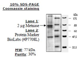 Metnase (SETMAR) human, recombinant, expressed in FreeStyle 293-F cells, >=30% (SDS-PAGE)