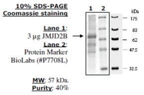 JMJD2B Active human, recombinant, expressed in baculovirus infected insect cells, >=40% (SDS-PAGE)